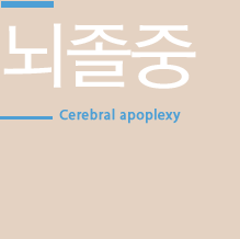 뇌졸중