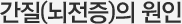 간질(뇌전증)의 원인